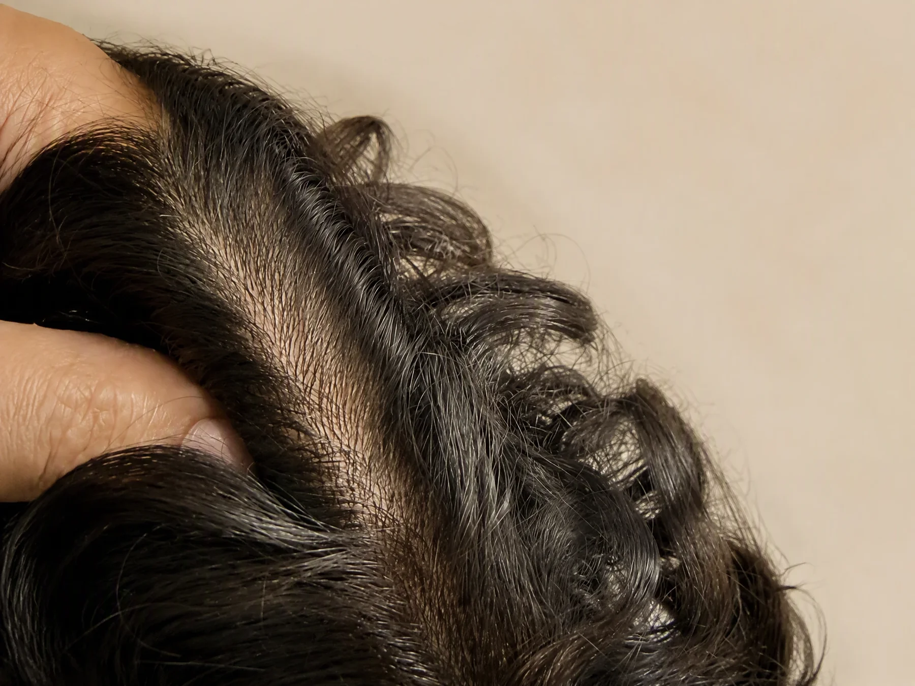 Primer plano de la raya natural del cabello en una prótesis capilar inyectada Arthur Fitz.