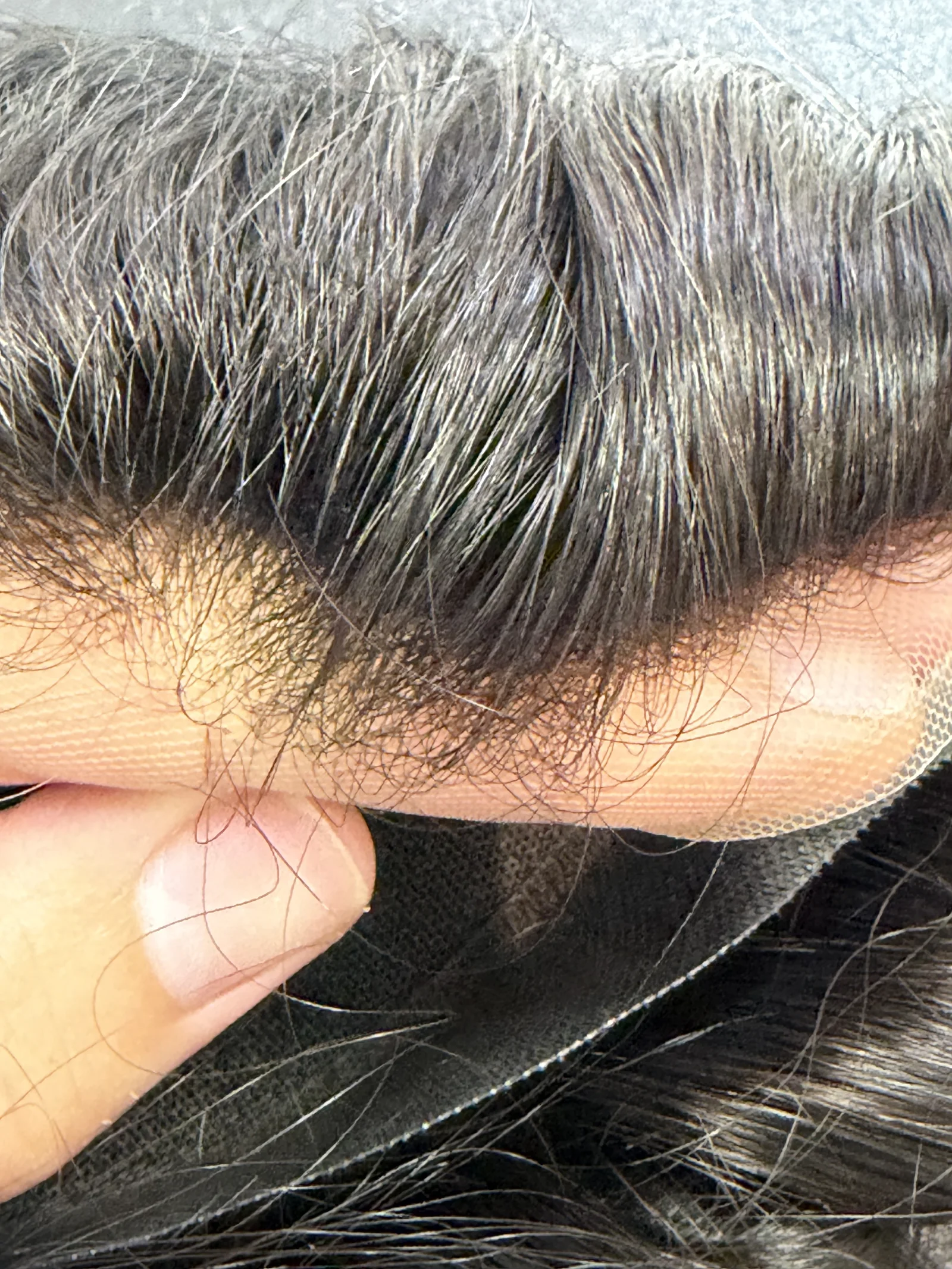 Fotografía real del frontal y el nacimiento del cabello.
